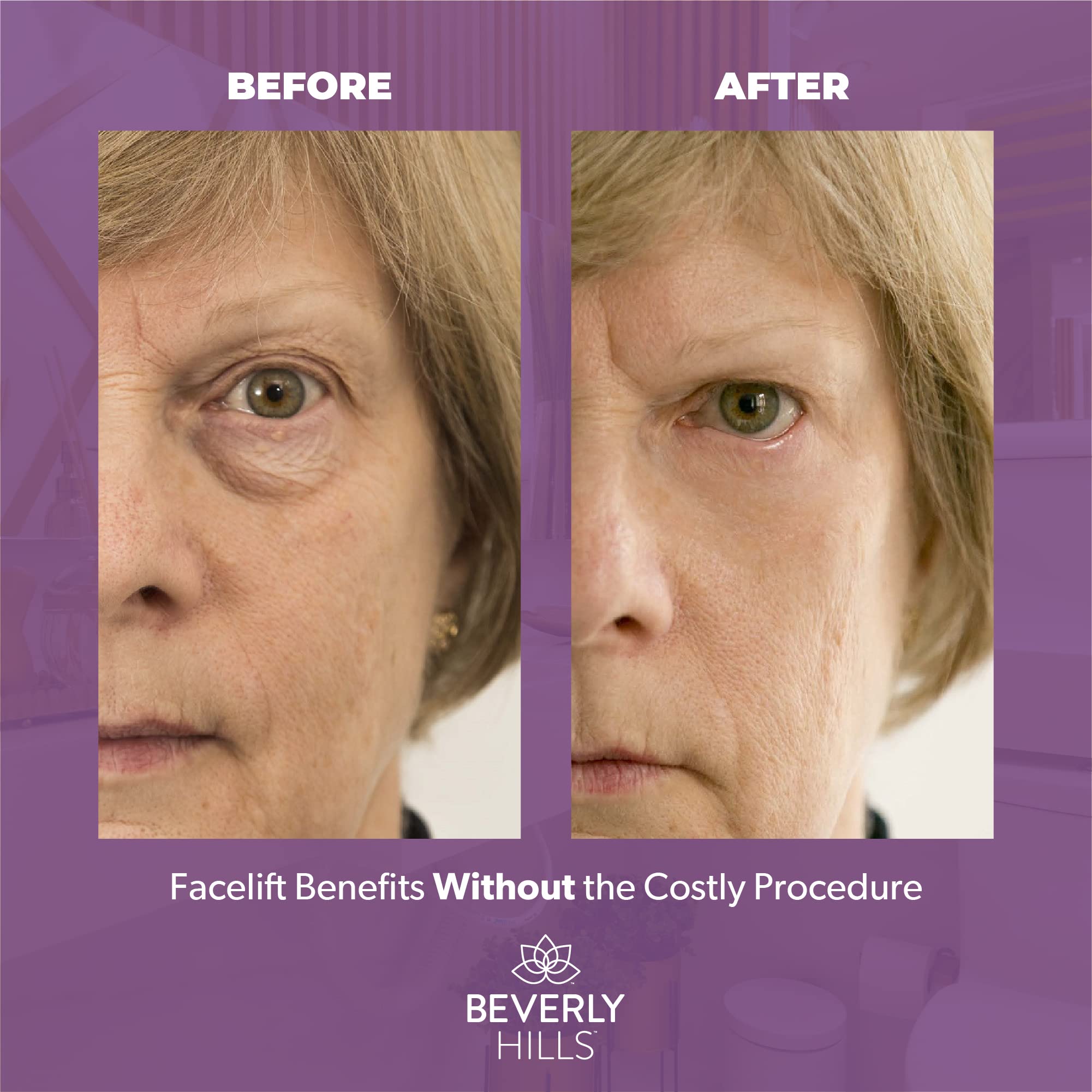 Beverly Hills Instant Facelift & Eye Tuck 30ml